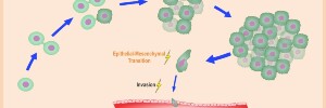 RNA and Cancer Biology